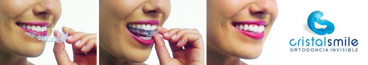 Ortodoncia Invisible Cristal Smile Rosario Ortodoncia